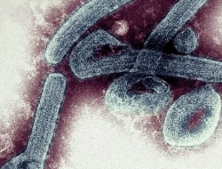 Ethiopia Konfirmasi Wabah Virus Marburg yang Mematikan Mirip Ebola